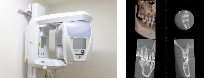 3Dパノラマ撮影装置